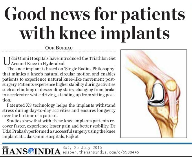 knee-implants